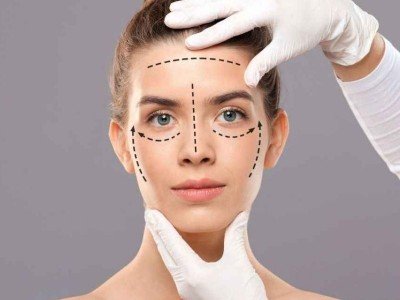 İğnesiz PDO Kolajen İp Protokolü